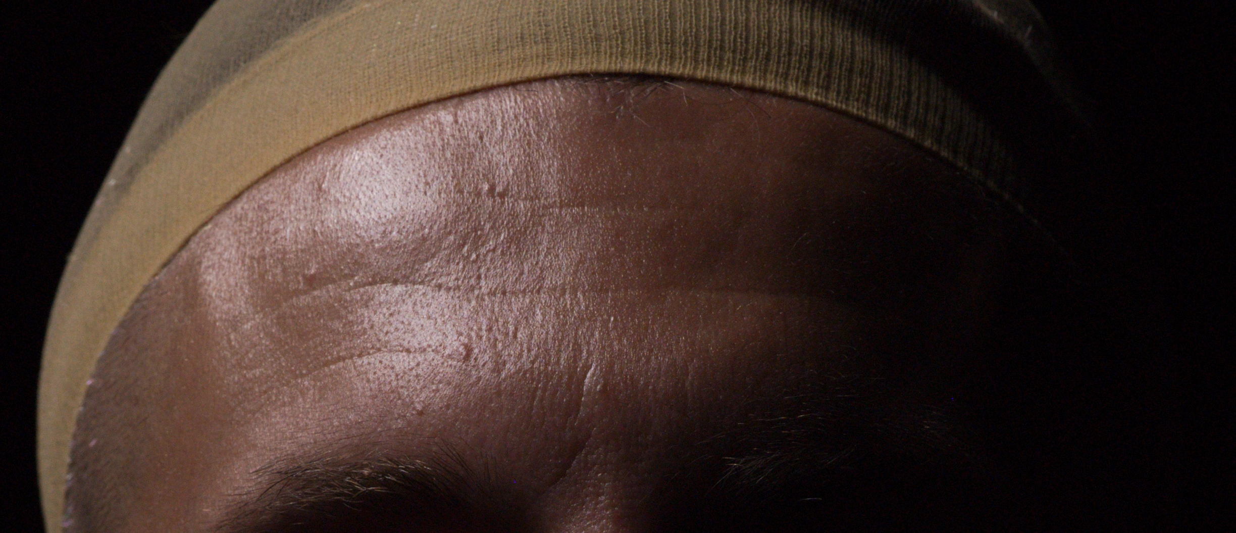 Forehead surface detail: real