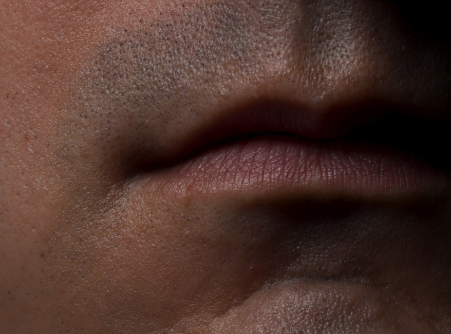Surface detail