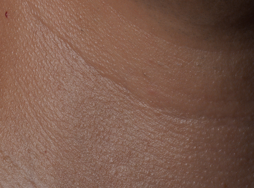 Skin texture